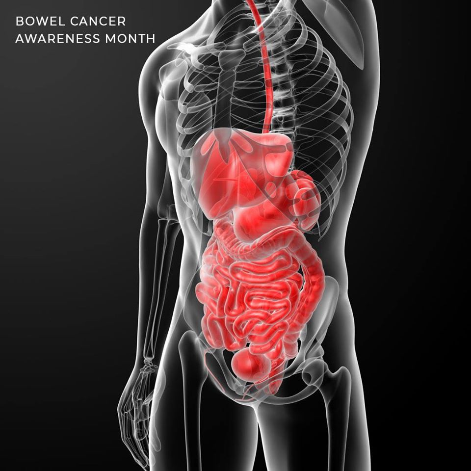 June is the Bowel Cancer Awareness month, for early cancer detection, Doctors in Adelaide