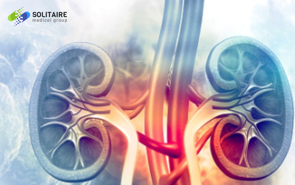 Kidney Stones are effectively treated and managed by a Urologist or a Urological Surgeon, Solitaire Medical Group