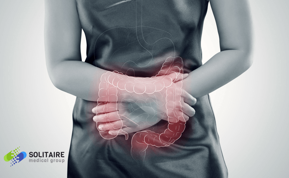 A woman suffering from Crohn's disease has sudden flare ups such as abdominal pain
