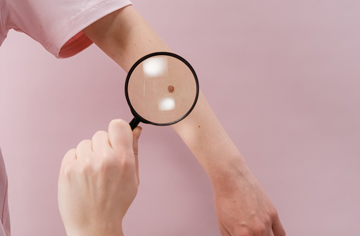 5 Common Concerns Answered About Skin Cancer Checks in Adelaide for Families